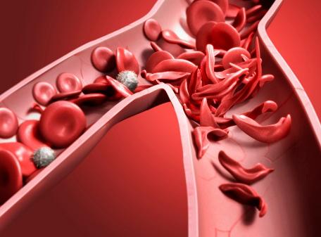 血小板低是抗凝禁忌吗,血小板减少要禁忌什么食物