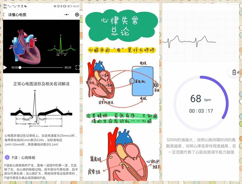心脏动态监护仪推荐,医用心脏监测仪检测内容