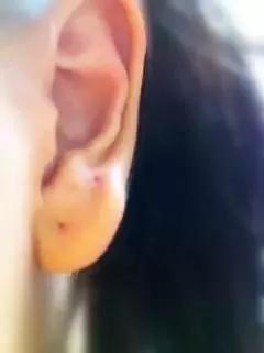 一块钱的红霉素眼膏,1-2块钱的红霉素眼膏长什么样