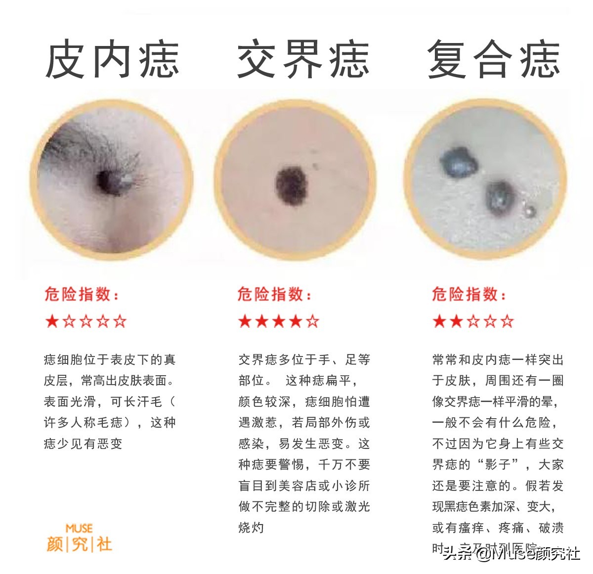 眼下有痣胸上也必定有痣吗,左胸有痣在上右胸有痣在下