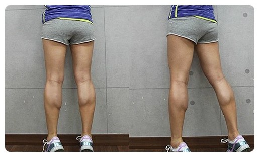 跑步一年脚为什么会变大,跑步小腿变粗了怎么细下来