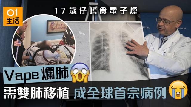 韩国爆发的加湿器消毒剂,韩国加湿器的危害真实事件