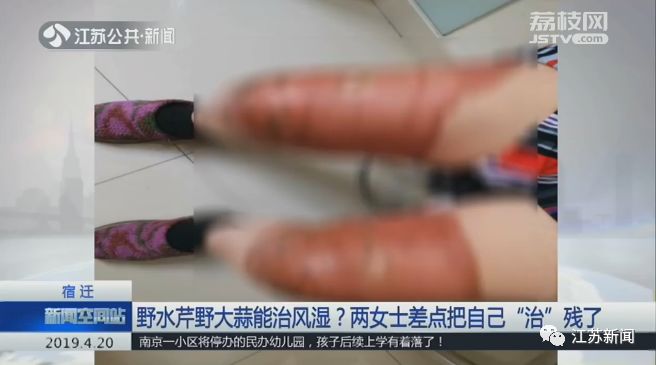 这种野菜不但好吃还能入药,啥野菜治风湿肩膀疼痛