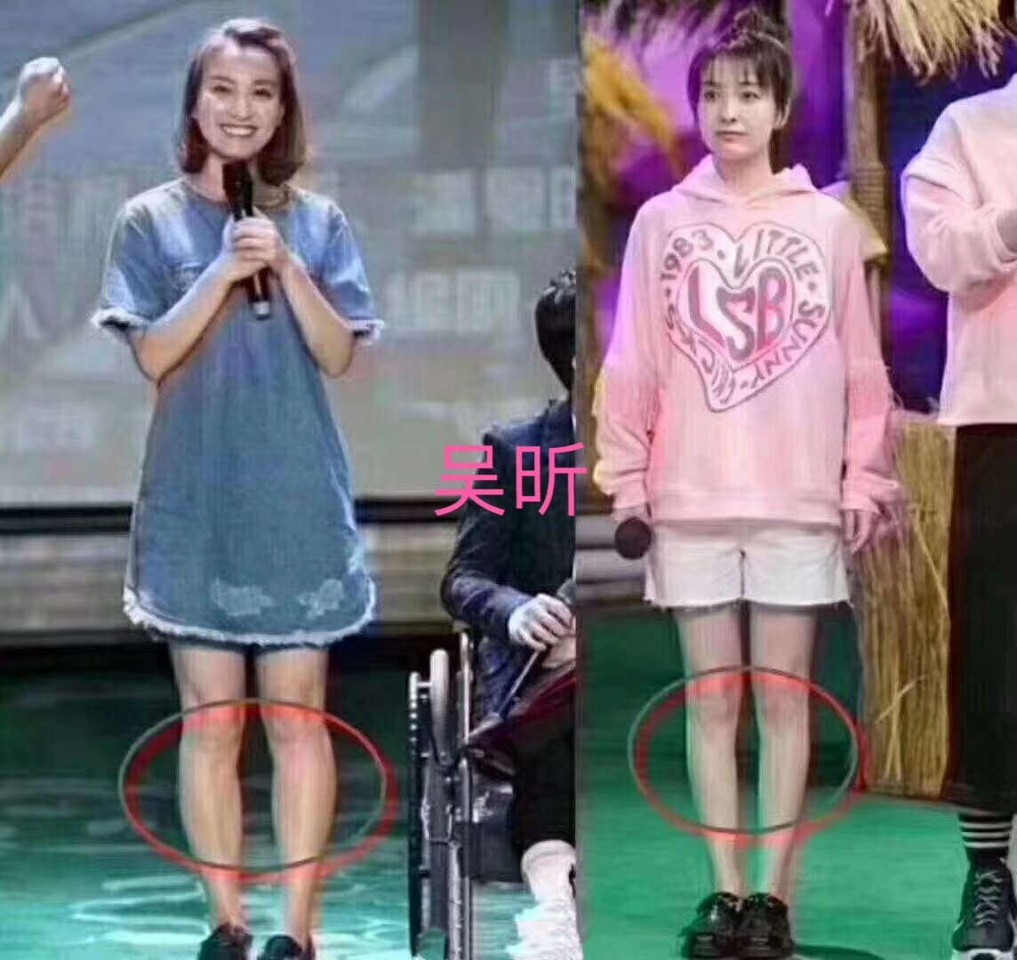 吴昕怎么改善o型腿,吴昕是怎么减掉小粗腿
