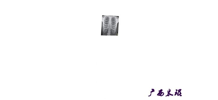 广西骨科医生米琨最新信息,米琨广西骨科什么水平