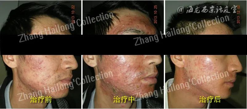 战戟小马达是内发泡吗,战戟小马达颜色