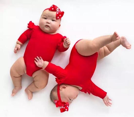 最特别的胎记，未出生的姐姐给胞弟留下的特殊回忆，让人感动