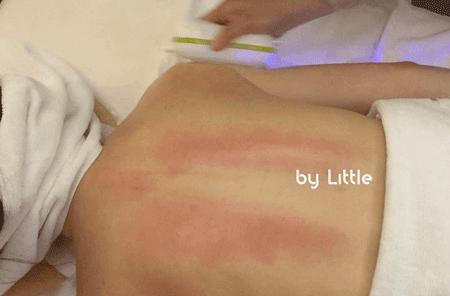 精油开背美容院教程,精油开背美容院正确使用方法