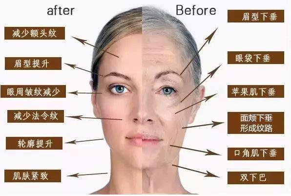 名医访谈｜上海同仁医院：光电治疗常见问题解答