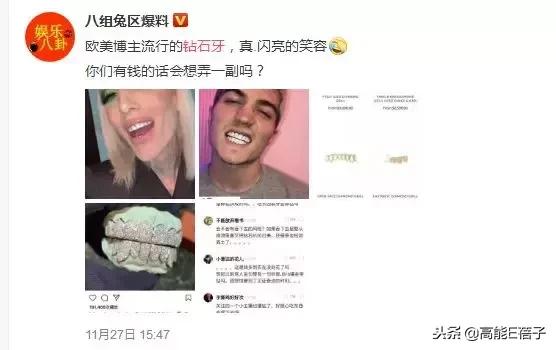 J姐的钻石牙，HBA的双头鞋……看得我只想好好当个穷人