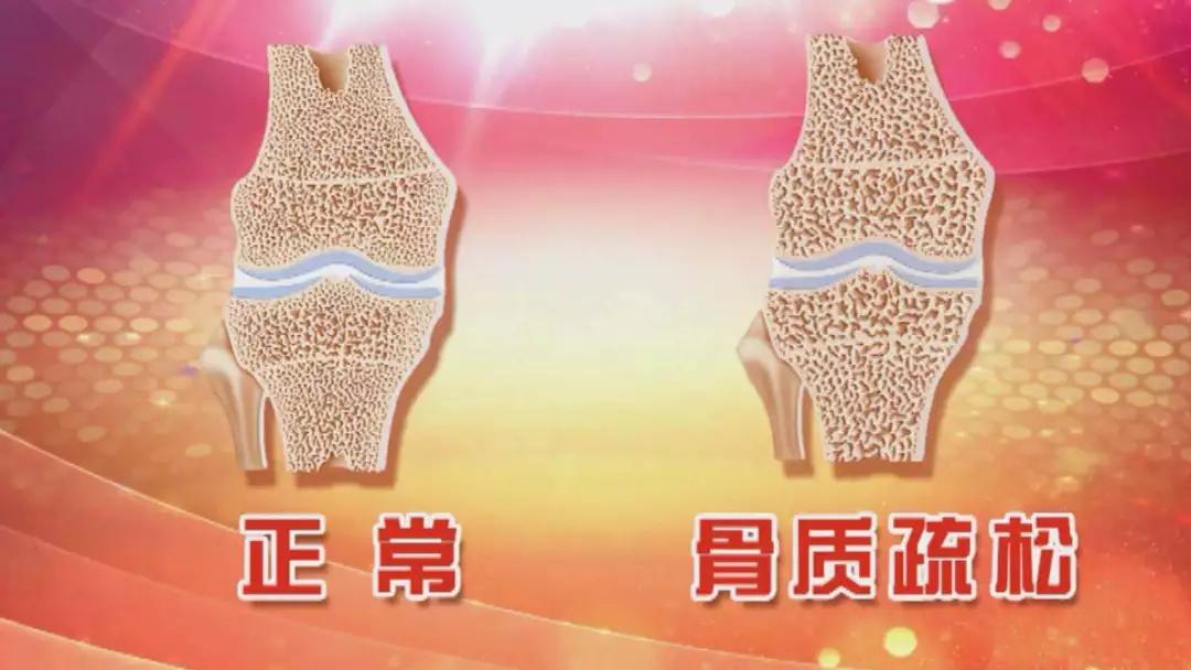 哪些人群需要特别注意补充蛋白质,蛋白质吃多了需要补充什么