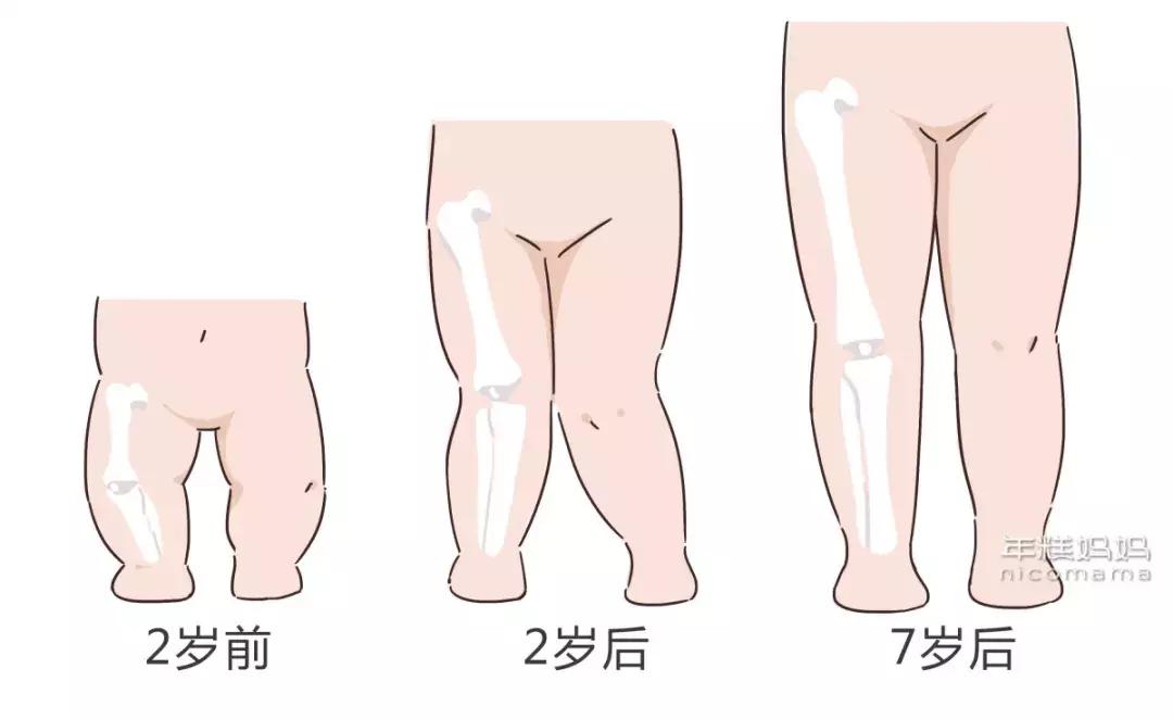 小孩穿什么鞋子有助于脚发育,宝宝鞋子会影响腿型吗