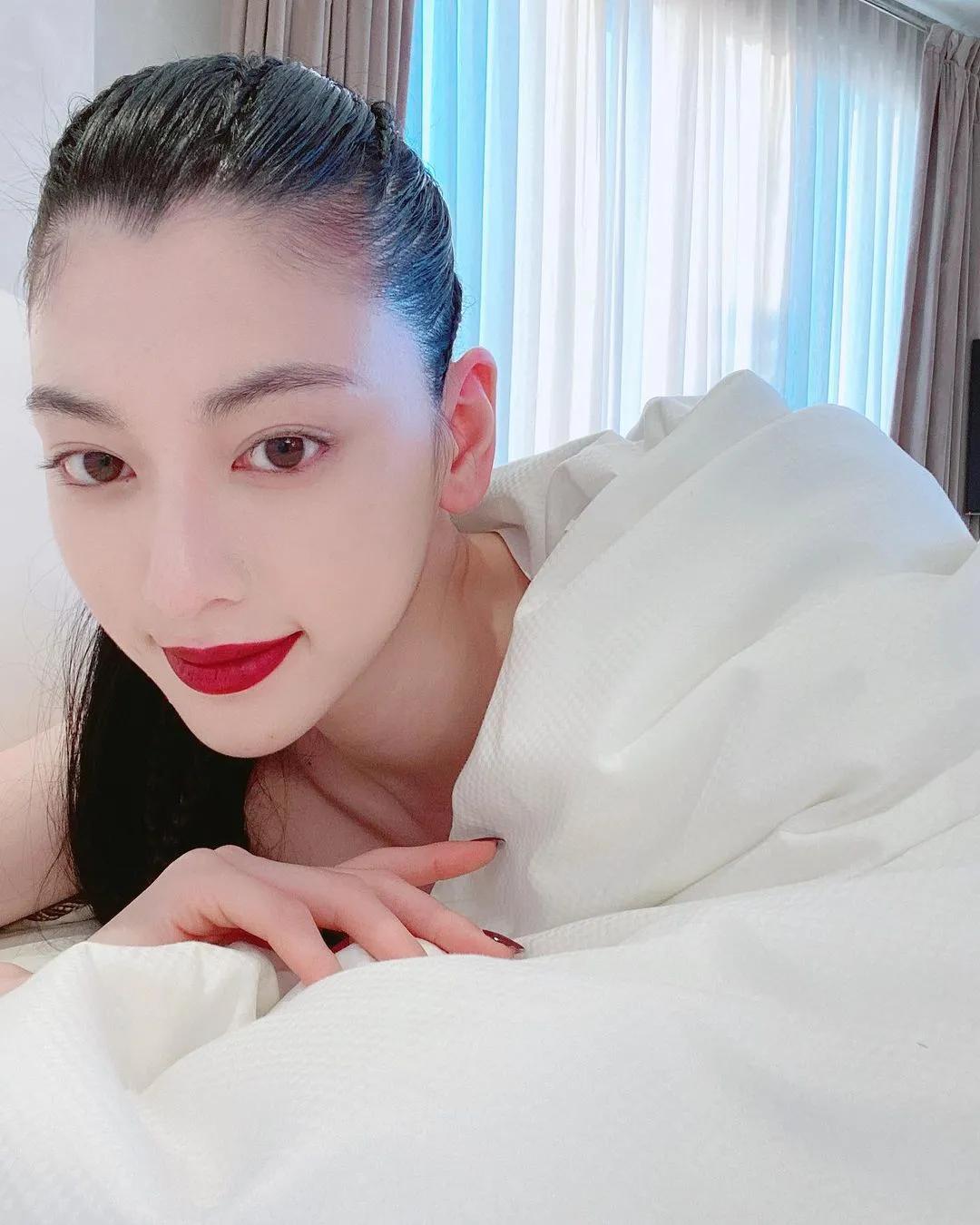 凸嘴怎么自己改善视频,纠正凸嘴后的对比照片