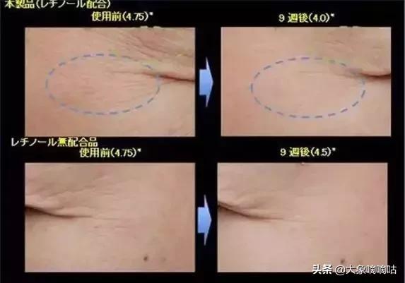 保湿去皱的眼霜哪款好,保湿祛皱眼霜哪个效果好