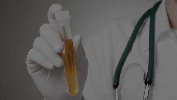 尿液出现这个情况，当心是膀胱癌来袭！日常做好8件小事挡住它