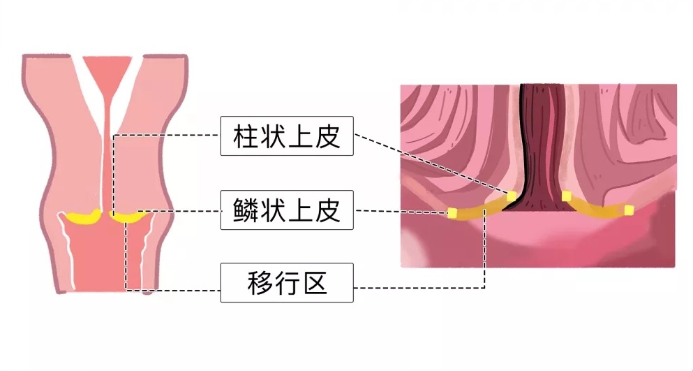 没有对象会有炎症吗,没有对象会得梅毒吗