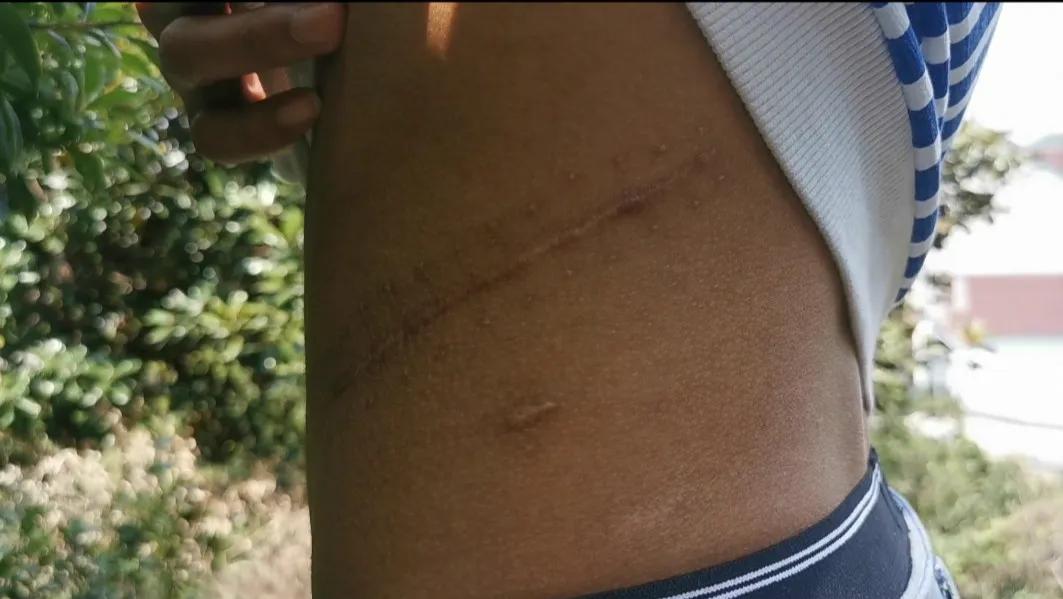 废弃厂房里的“卖肾”交易:买肾人花55万,卖肾人得4.5万