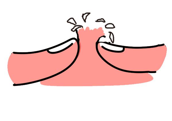 抗痘真实推荐药膏,挤痘痘最有效的药膏