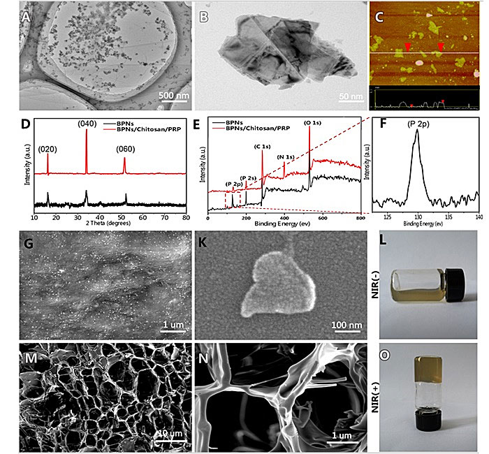 基于黑磷纳米片的多功能温敏水凝胶系统治疗类风湿