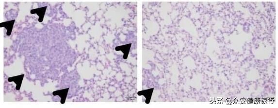 重磅级文章解读古老药物的新用途！