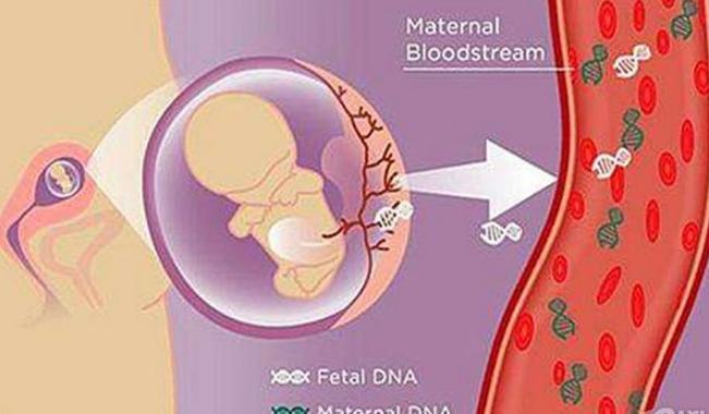唐筛检查显示低危,要不要再做无创DNA?有疑惑的孕妈可以看看