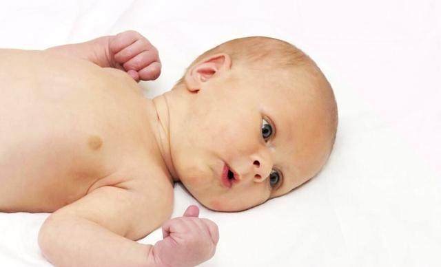 新生儿黄到什么程度有黄疸,出生10多天的宝宝黄疸是什么原因