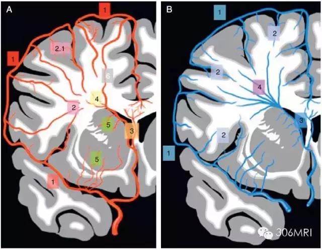 大脑深部白质区见斑点状异常信号,脑白质病变建议mri检查是什么意思