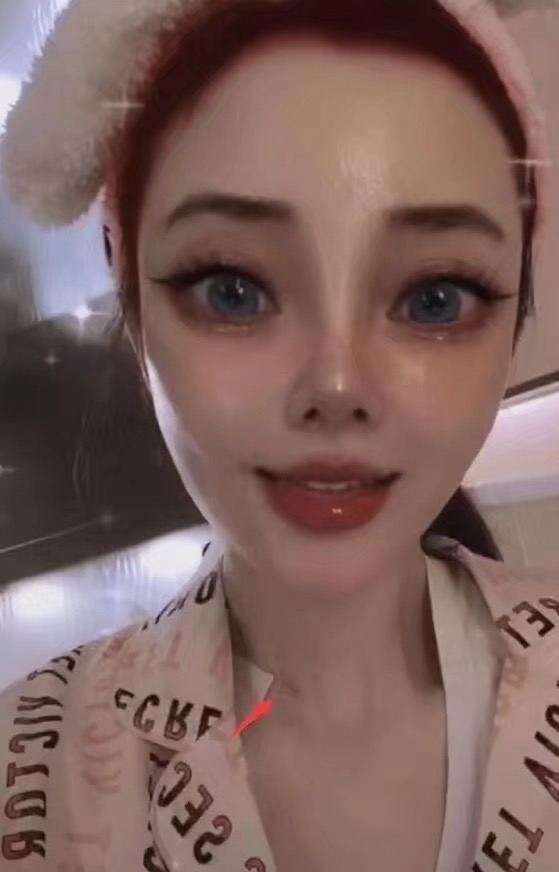 破案了！李小璐脖子“吻痕”不是贾乃亮种草莓，点痣身上没黑点