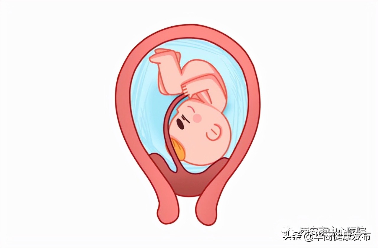前置胎盘到底可不可怕,为何会出现前置胎盘