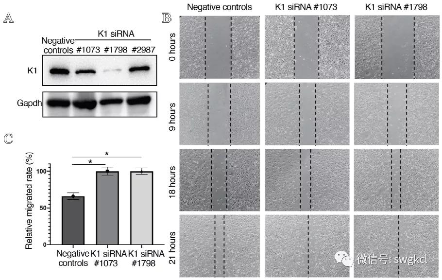 粘着斑相关蛋白Kindlin-1在血管内皮细胞的表达及功能研究