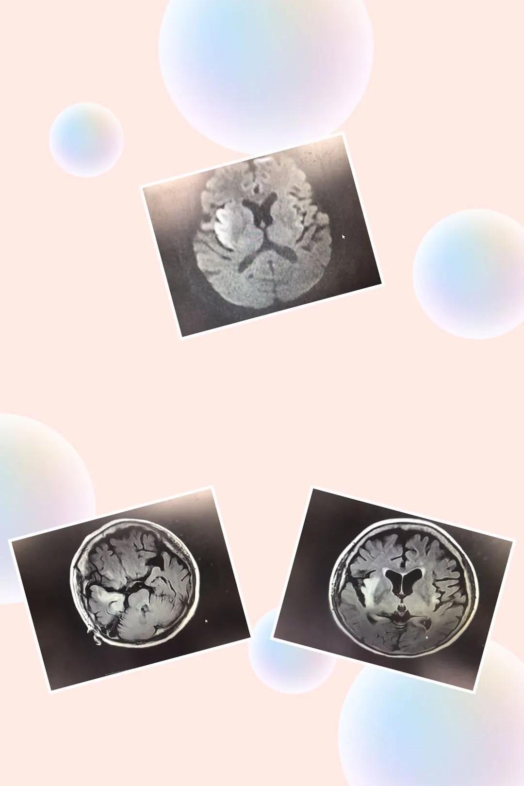 唐山市人民医院神经内一科,看亮点