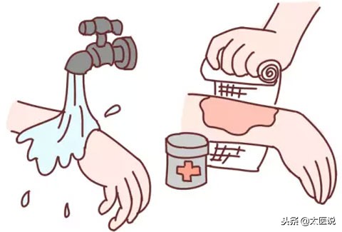 发生烫伤时的应急处理方法,男子被开水烫伤