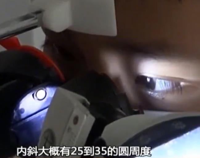 一小孩变斗鸡眼,小孩突然成斗鸡眼