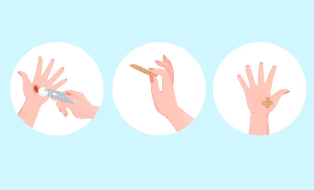 做饭烫了个泡竟然得了破伤风,做菜感染破伤风