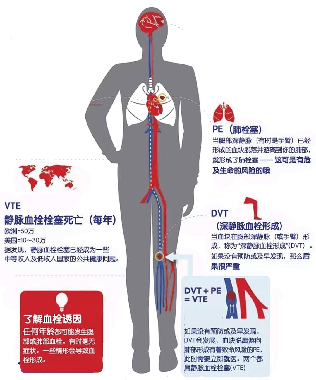 张强医生集团启动静脉血栓“空中门诊”(每日限量提供体验兑换券
