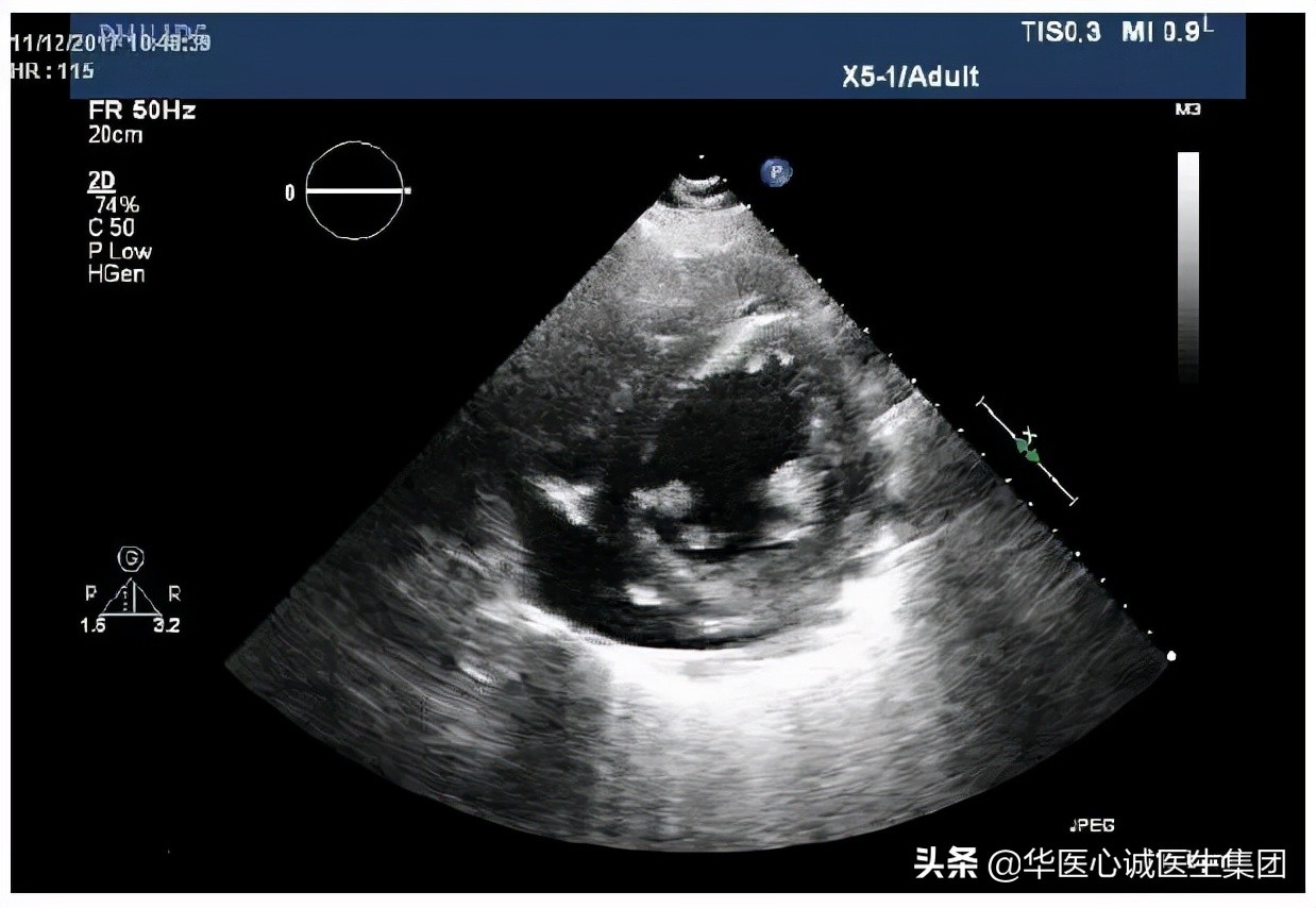 杨颖局部图,杨颖早期下颌宽大