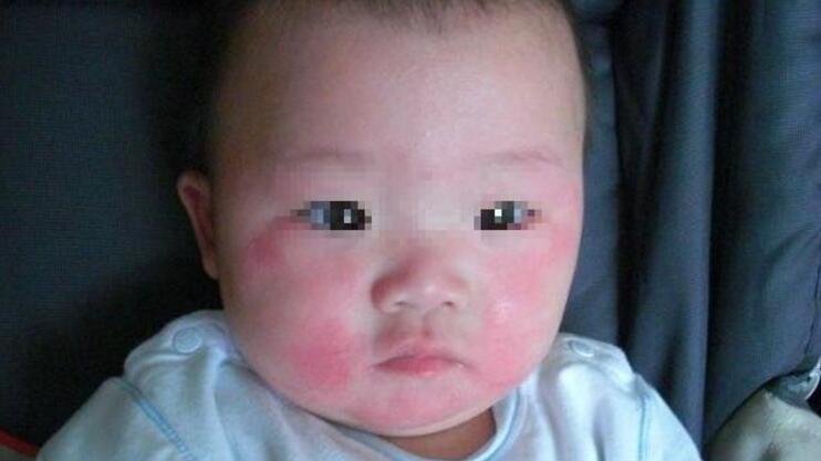 林志颖推荐的宝宝面霜,林志颖面霜价格表