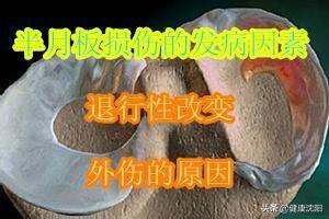 健康科普膝关节疼痛怎么办,健康大问诊半月板损伤治疗方法