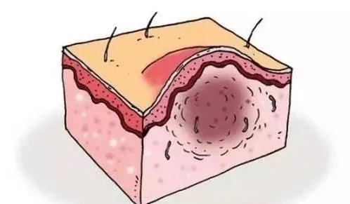 头皮和脸上长痘痘,小孩头皮上长痘痘