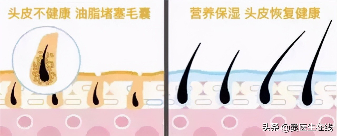 体毛刮掉的好处和坏处,体毛要不要刮掉要一直处理吗