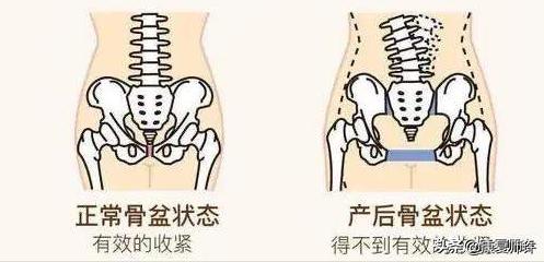 产后腹直肌分离恢复瘦肚子训练,产后腹直肌分离恢复的最佳方法