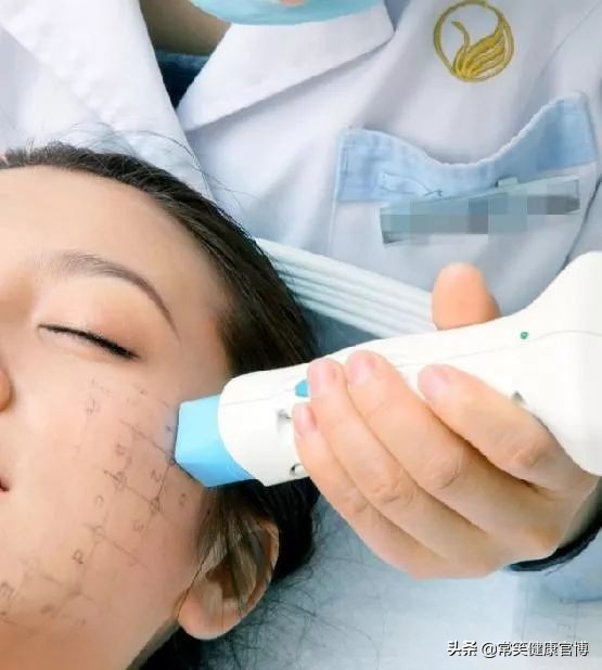 除了热玛吉还有什么抗衰仪器,抗衰美容仪器热玛吉