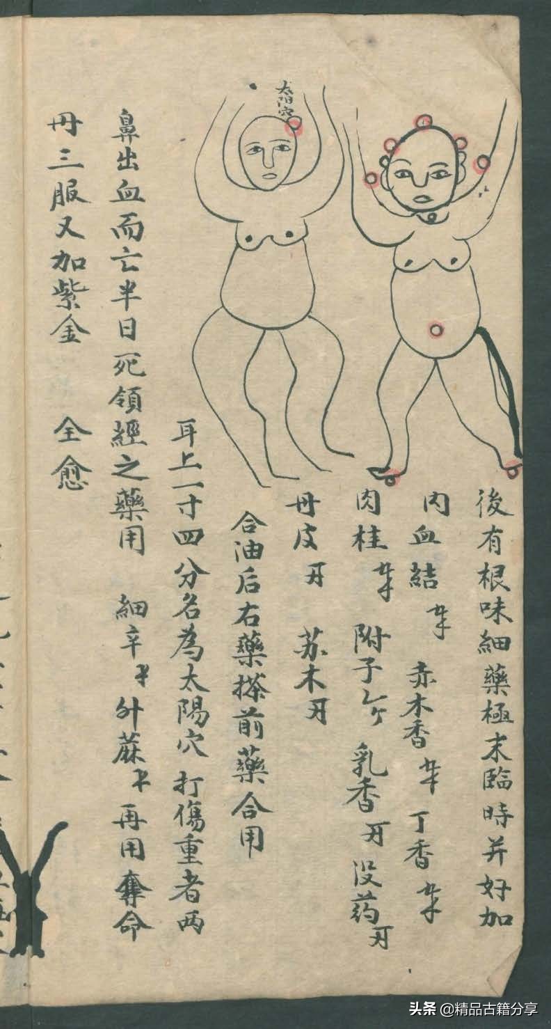 中医类抄本跌打损伤方面的医书欢迎阅读