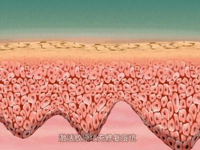 反孔大作战专治你的毛孔粗大