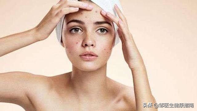 脸上有血丝是肝脏出了问题了吗,脸反映的是什么器官