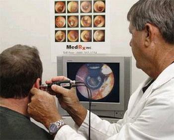 分泌性中耳炎的科普,分泌性中耳炎需要注意什么