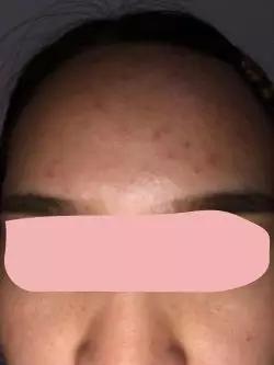 你的脸不是一般的脸,别让自己的脸成了护肤品试验田