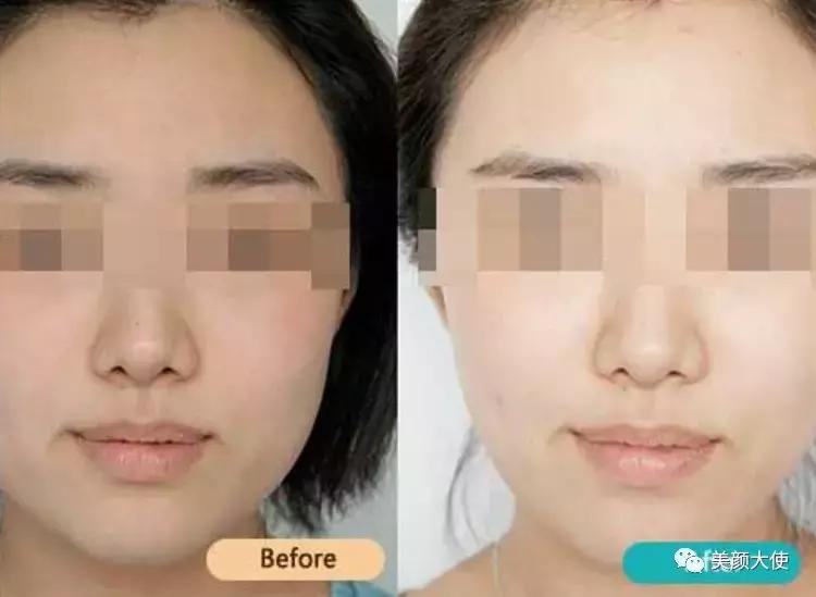 什么是白脸娃娃,什么是瓷娃娃