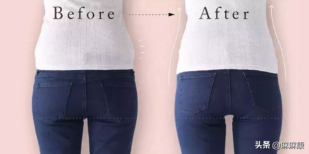 怎么改善产后假胯,消除产后假胯宽