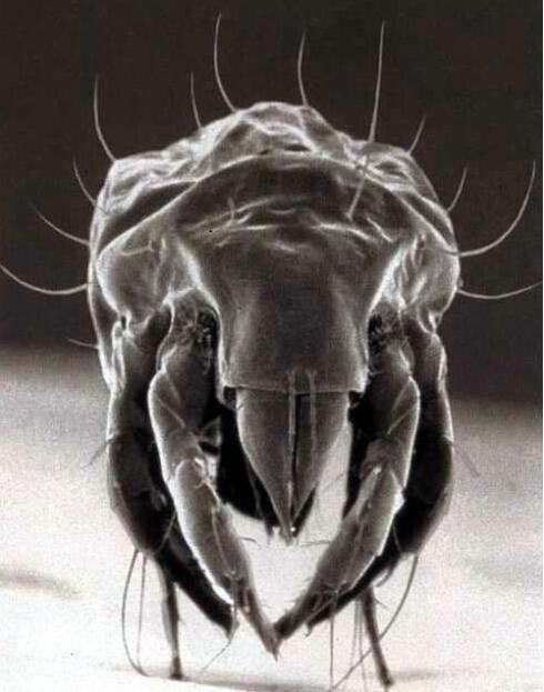 为什么脸上的螨虫反反复复,螨虫最怕什么药脸上有螨虫怎么治